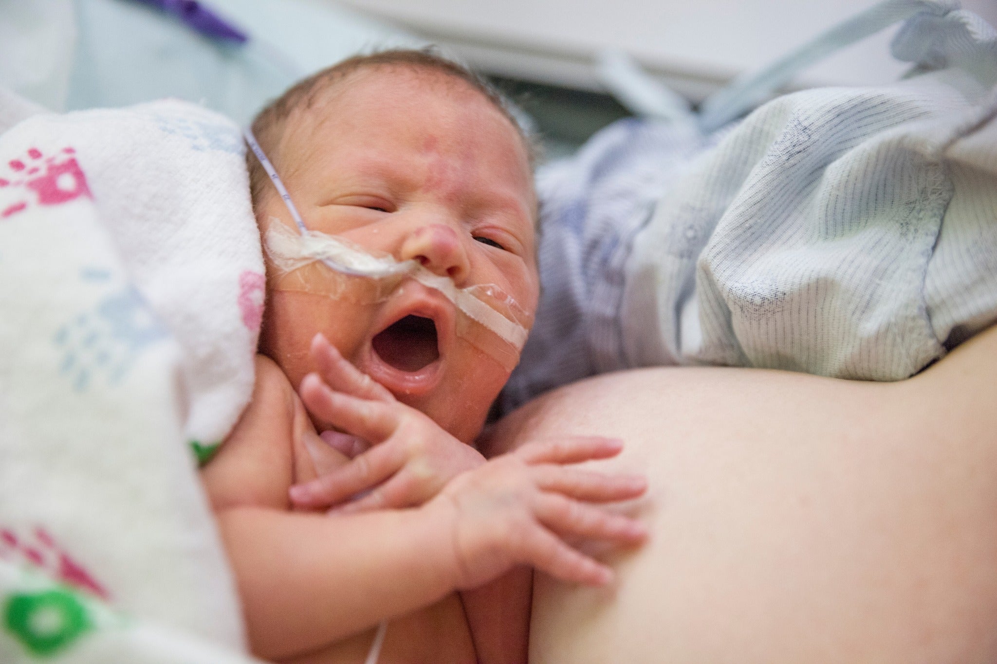 Understanding the Challenges of Feeding Premature Babies - bökee